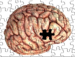 Cientistas buscam entender proteína no cérebro relacionada ao Alzheimer