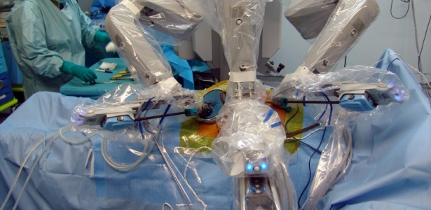 O robô Da Vinci usado no transplante de rim; veja no álbum do mês - EFE / Hospital Universitario AOUP