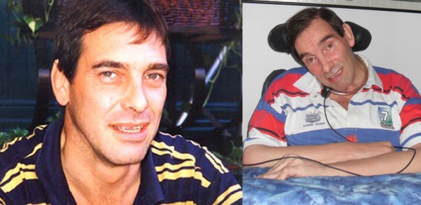 Tony Nicklinson antes e depois do derrame - PA
