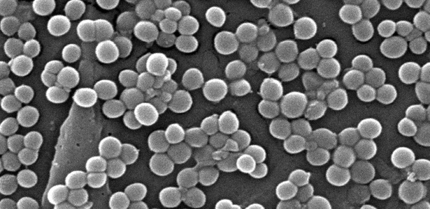 Cepa da bactéria do grupo gram-positivo <i>Staphylococcus aureus</i>, que pode ser combatida pelo novo antibiótico teixobactina - Efe/CDC