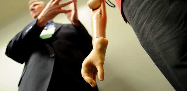 Médico apresenta o braço biônico controlado pela mente do usuário; veja no álbum - AFP/Jim Watson