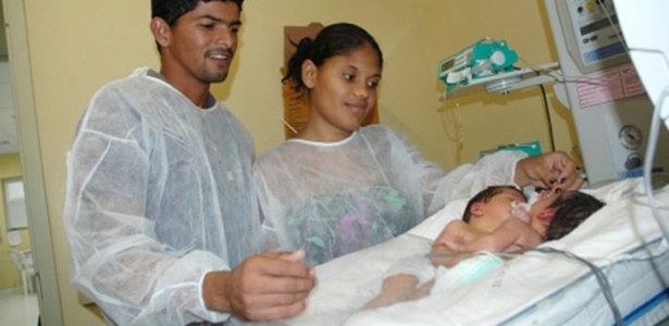 Gêmeas siamesas nasceram com coração fundido e estão na UTI - Ricardo Pinho/FHS